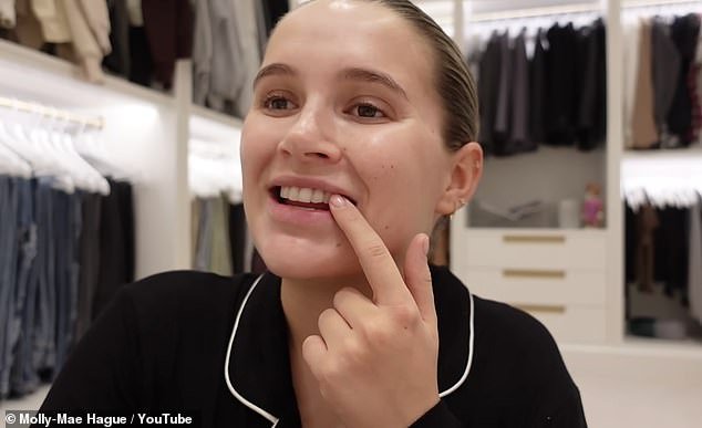 Tooth problems: the influencer confessed that she is insecure with her teeth