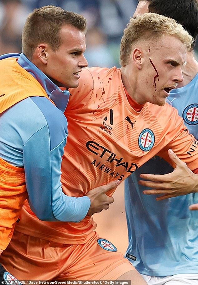 Melbourne City goalkeeper Tom Glover had to be escorted off the pitch after he was attacked with a metal container during embarrassing scenes on December 17.