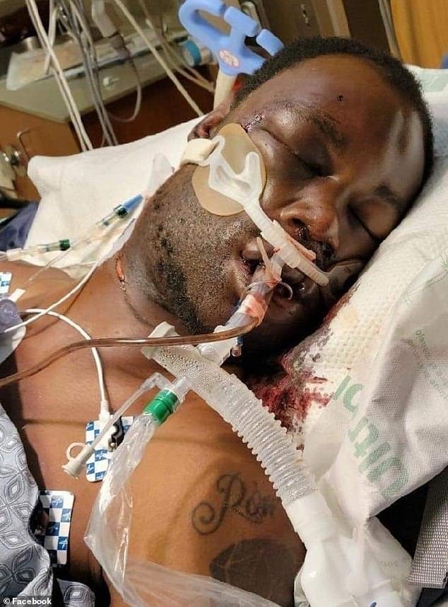 Tire Nichols is shown at the hospital after the incident.  The 29-year-old from Memphis died on January 10 of cardiac arrest and kidney failure.