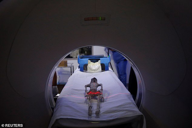 The small body was subjected to a CT scan yesterday at the Noor Clinic in Huixquilucan, Mexico