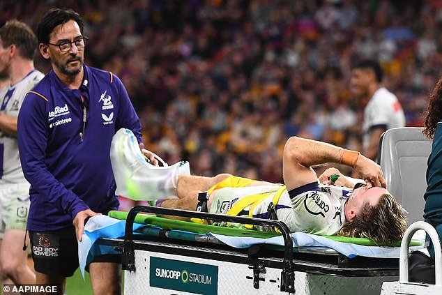 Medics initially feared the Melbourne Storm star had suffered a more serious compound fracture due to blood on his sock
