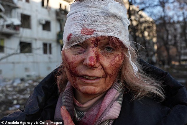 An injured woman is seen as airstrike damages an apartment complex outside Kharkiv, Ukraine on February 24, 2022.
