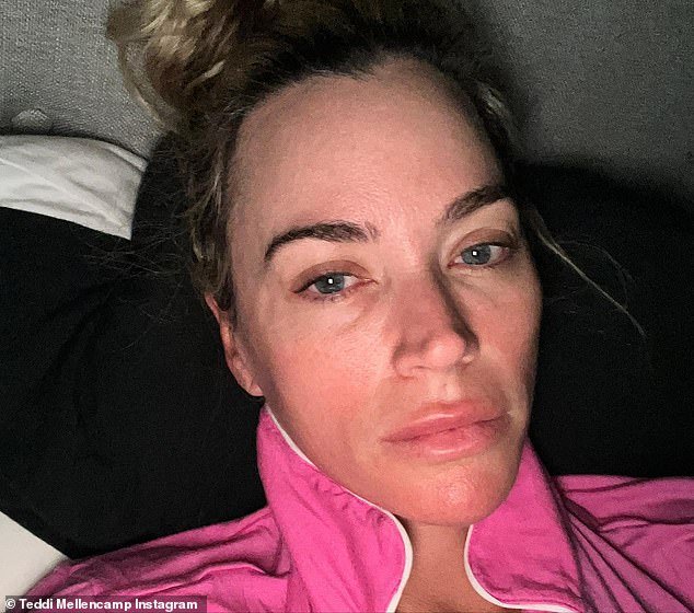 Try everything: at the end of September, Teddi announced some bad news.  She revealed that her surgeons were unable to remove every trace of the skin cancer, so she started immunotherapy to try to eradicate the remaining cells.