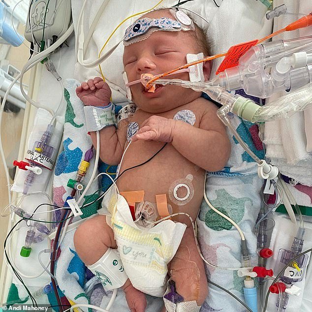 When it was time to give birth, the doctors were on standby to give baby Emmie oxygen.  She had to go straight to the operating room