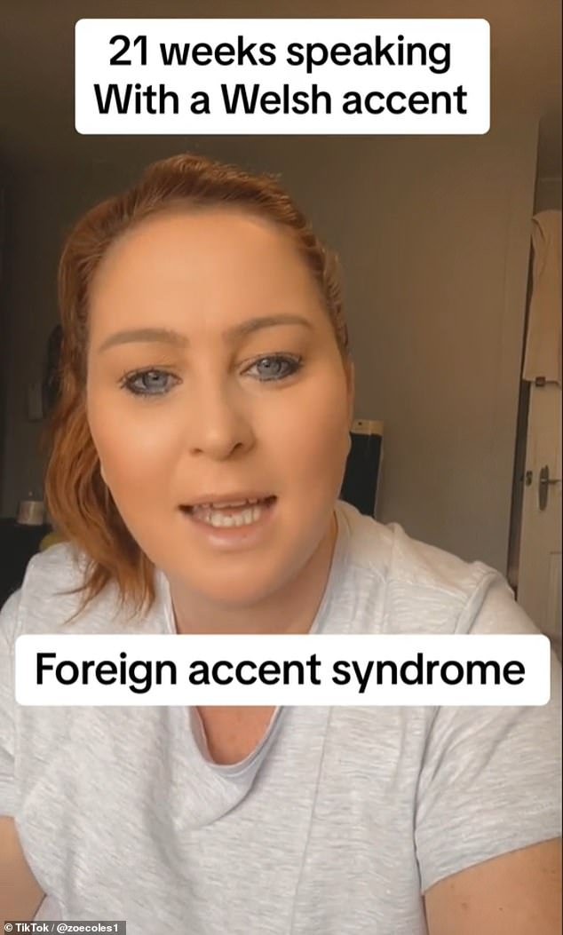 The Englishwoman revealed that she has been stuck with the Welsh accent for almost five months and shares the daily problems it causes her