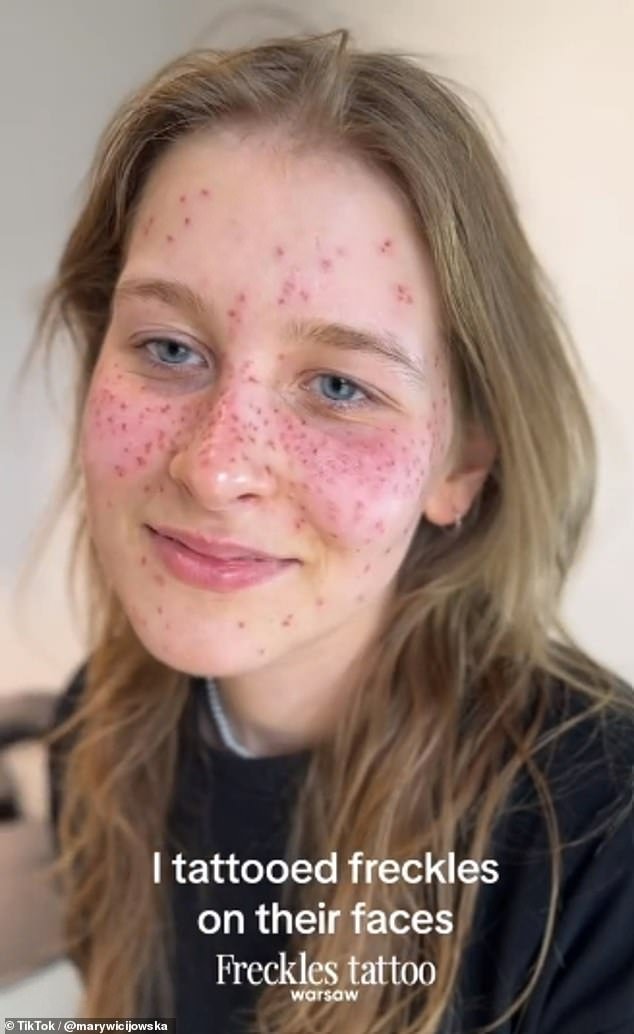 The freckles – which are extra pigment spots under your skin and also known as ephelides – appear to be inked red around the client's cheeks, nose and forehead areas