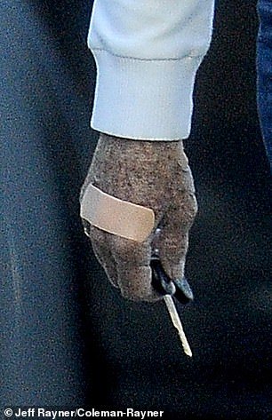 She also had a bandage covering a minor injury on her right hand