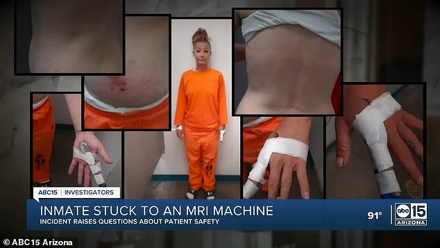 Lacey Windust, 38, was in an Imaging Center at SimonMed when a technician told the guard not to remove the handcuffs, causing her to fly toward the MRI machine and get stuck in the hole.