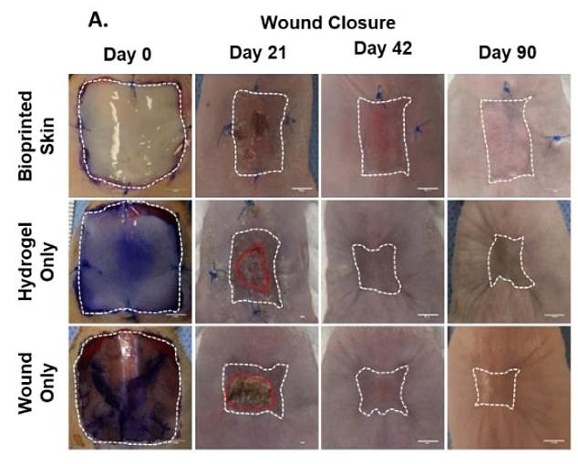 Bioprinted skin was grafted onto wounds in mice and monitored for 90 days, alongside a control group that received a hydrogel graft and a group that received traditional wound dressings and nothing else.  The bioprinted skin grafts helped the wounds heal by sending healing skin cells to the wound site instead of forcefully pulling the skin together (contraction)