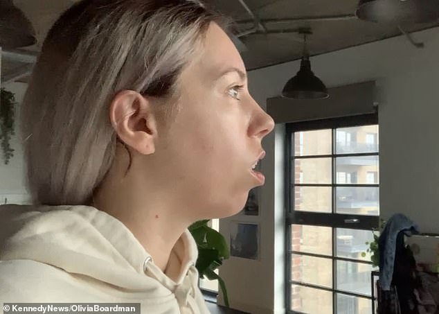 The film and TV trailer maker said the condition left her feeling constantly confused and tired, and the situation became so dire that she even swore off dating (Picture: Olivia with an overbite)