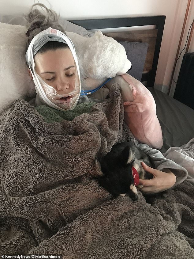 Olivia's newfound confidence is thanks to life-changing £25,000 double jaw surgery (Pictured: Olivia recovers after surgery)