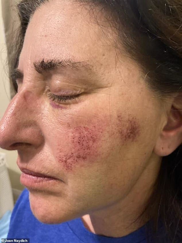 She was violently attacked in February at Matanzas High School by Brendan Depa, then 17, after she told him to stop playing his Nintendo Switch.