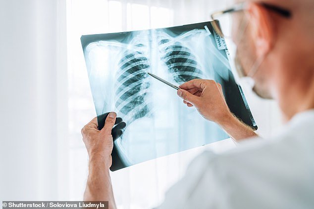 The shortness of breath means your heart muscle isn't working efficiently - reduced blood flow means less oxygen is available to your lungs, writes Dr Martin Scurr (Stock Image)
