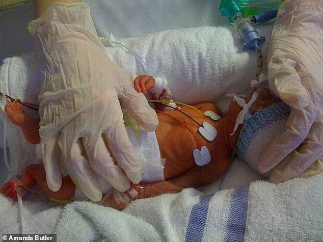 Callum Butler (pictured) was born after just 25 weeks of his mother's pregnancy.  His mother Amanda was later told that an infection she had called bacterial vaginosis was to blame.  The condition can also cause miscarriage