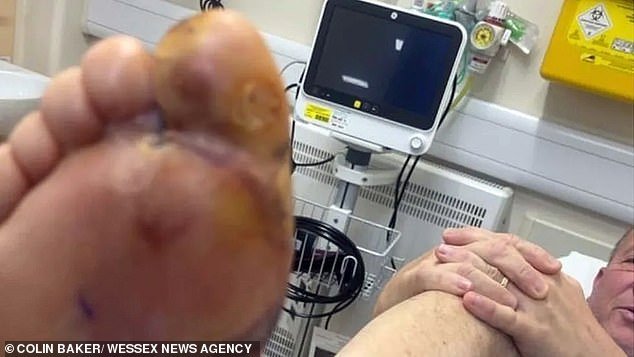 Colin's lying hospital in France.  He said: 'My wife thought it was because I had new sandals and they rubbed my big toe and it turned red.'