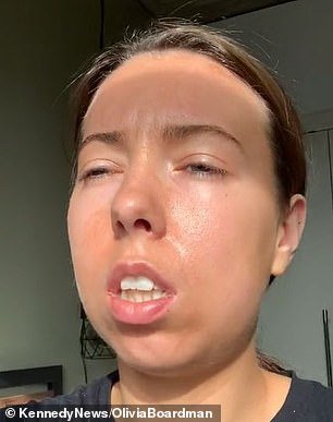 Olivia Boardman before oral surgery