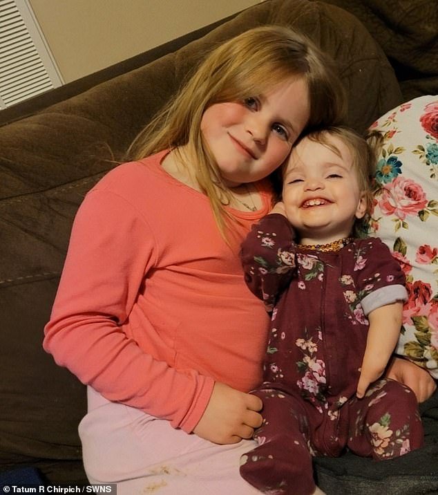 Kennedy, 9, and Dakota, 3, both have fibular hemimelia, which occurs due to a genetic mutation and affects only one in 40,000 people in the world
