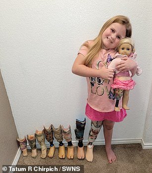 Kennedy had one leg amputated and now walks with a prosthesis whose pattern she can change