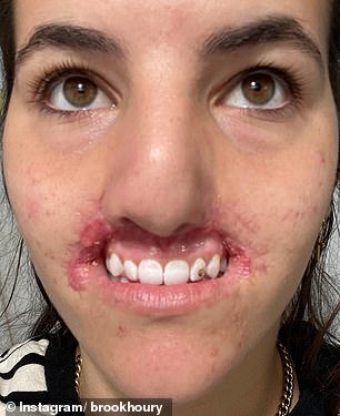 Brooklinn was attacked by a dog on November 2, 2020, while at her cousin's home in Arizona