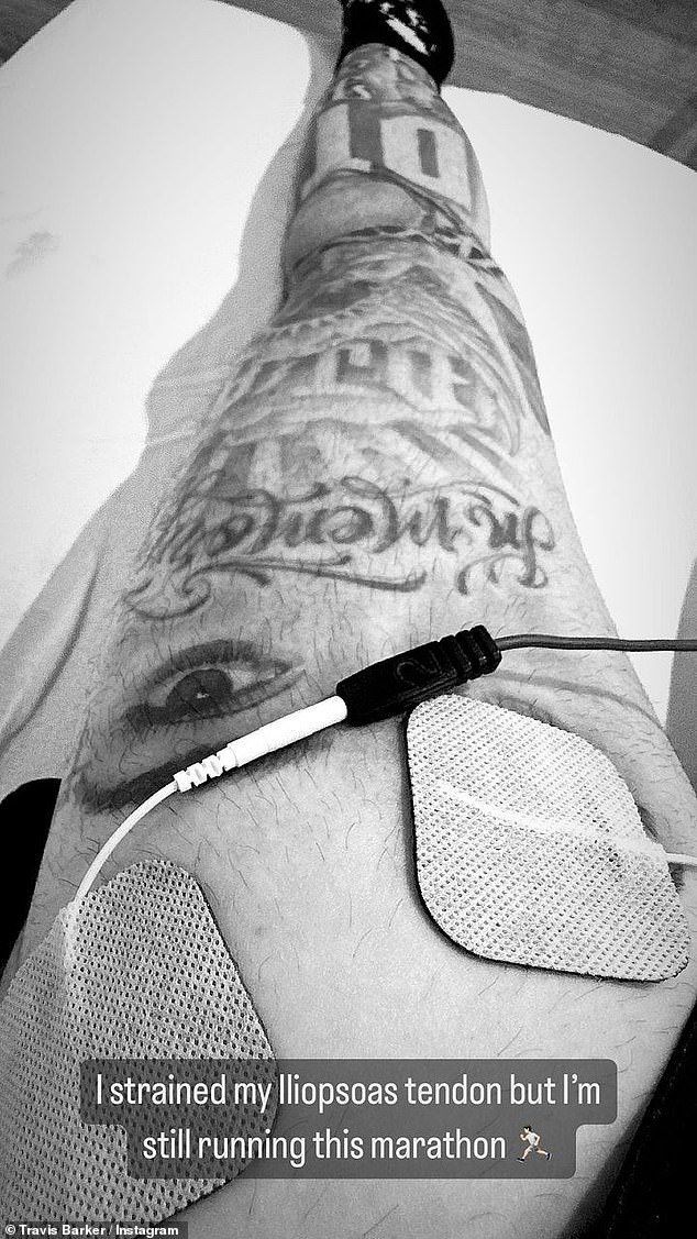 Travis also shared on his Instagram that he is running a marathon tomorrow despite straining his iliopsoas tendon
