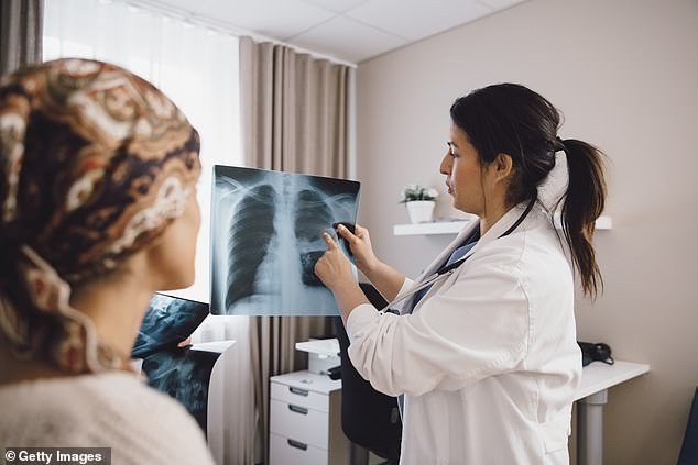 The researchers first fed the AI ​​model - called X-Raydar - nearly three million historical chest scans from 1.5 million patients and then taught it to check for 37 possible conditions (stock image)