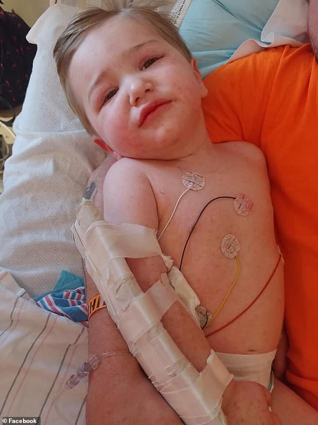 Jackson Oblisk contracted Rocky Mountain Spotted Fever, which left him with a full-body rash, high fever, and full-body swelling in 2019