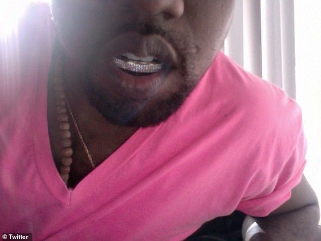 1705528108 593 Kanye West has teeth REMOVED and replaced with TITANIUM dentures