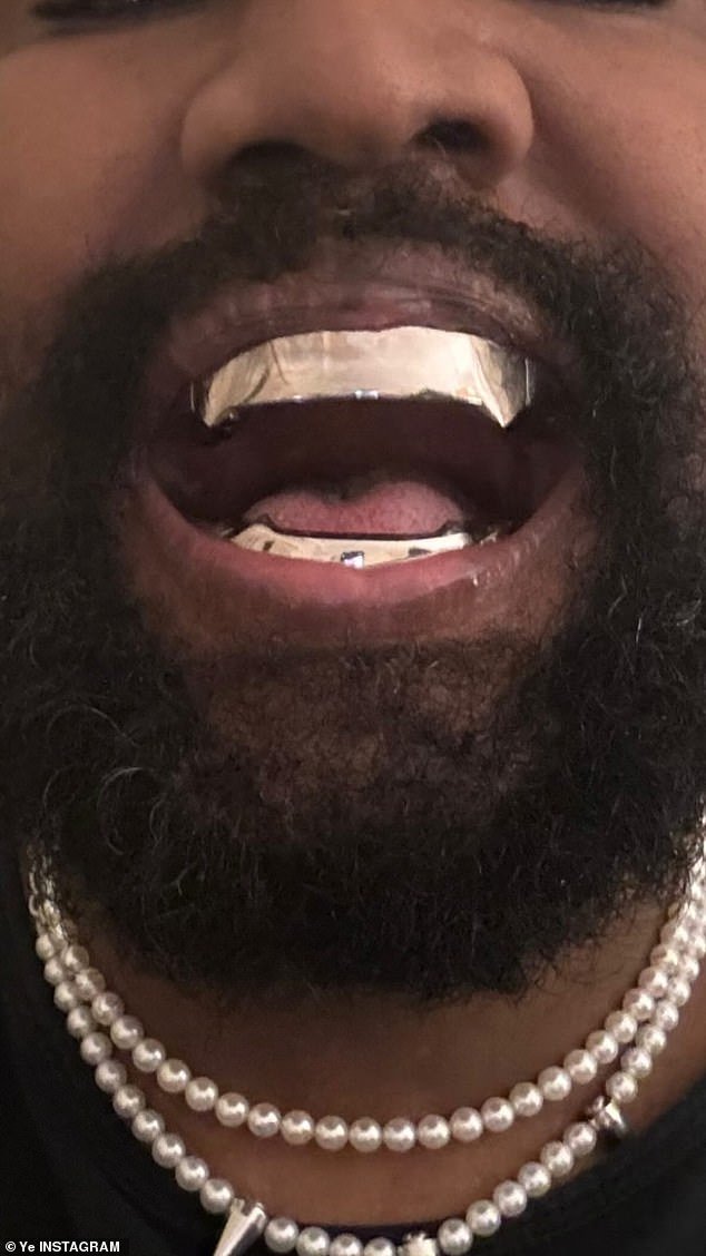 The rapper, 46, proudly showed off his pointy new smile in an Instagram post - in which he compared himself to iconic James Bond villain Jaws, who appeared in The Spy Who Loved Me and Moonraker
