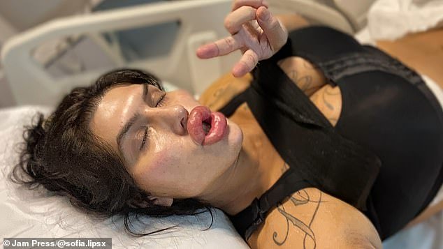 The influencer has apparently become obsessed with plastic surgery and plans to stretch her pout as far as possible