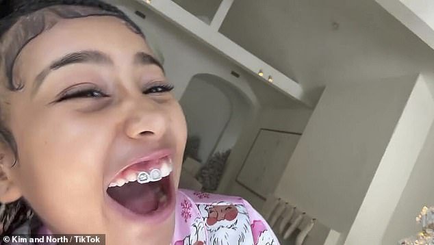 The slideshow included a selfie of the 10-year-old giving their followers a close-up look at the dental jewelry — amid her father, Kanye West's, revelation that he had his teeth removed and replaced with $850,000 titanium dentures.