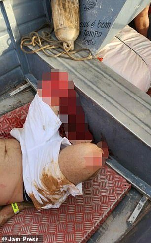 Images of the man on a small boat showed his left leg covered in blood