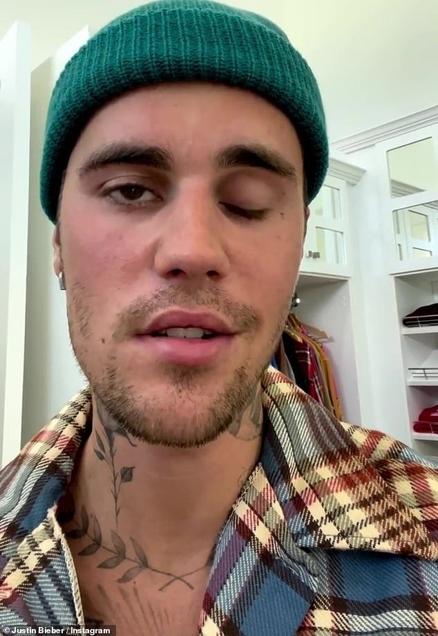 Bieber focused 'on his health' after suffering from facial paralysis caused by Ramsay Hunt syndrome – but recently performed in Toronto