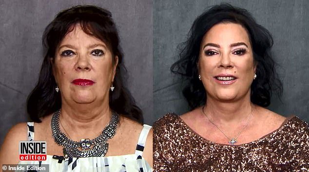 In 2016, Karen paid the ultimate compliment to the mother: she received an intensive facelift to 'look like my beautiful sister Kris'