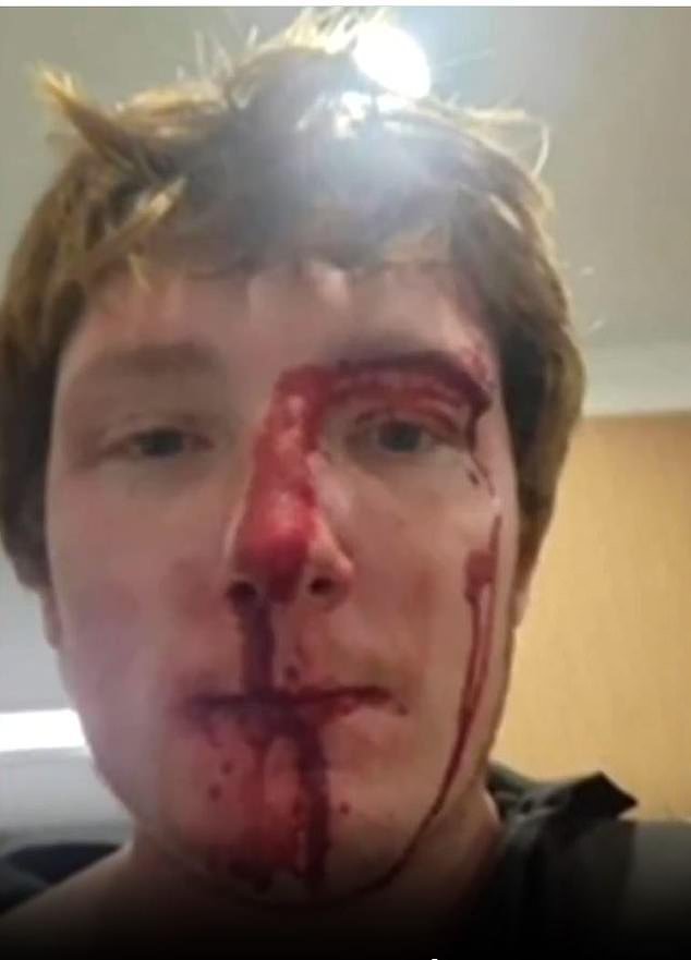 Khoby Dawson, 22, was left with a bleeding nose and a cut above his eye as a result of the attack (pictured) at the McDonald's in Raymond Terrace