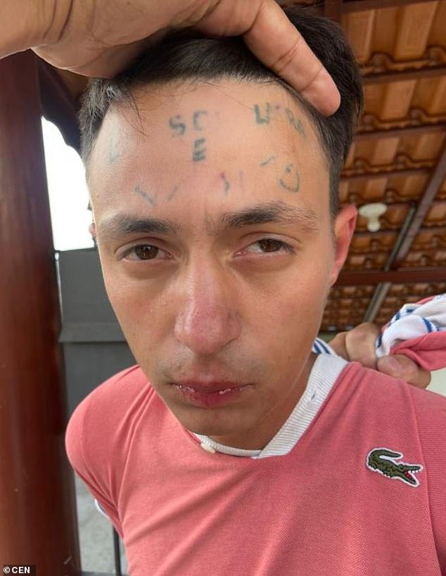 Da Silva had the tattoo partially removed, but some letters are still clearly visible on his forehead