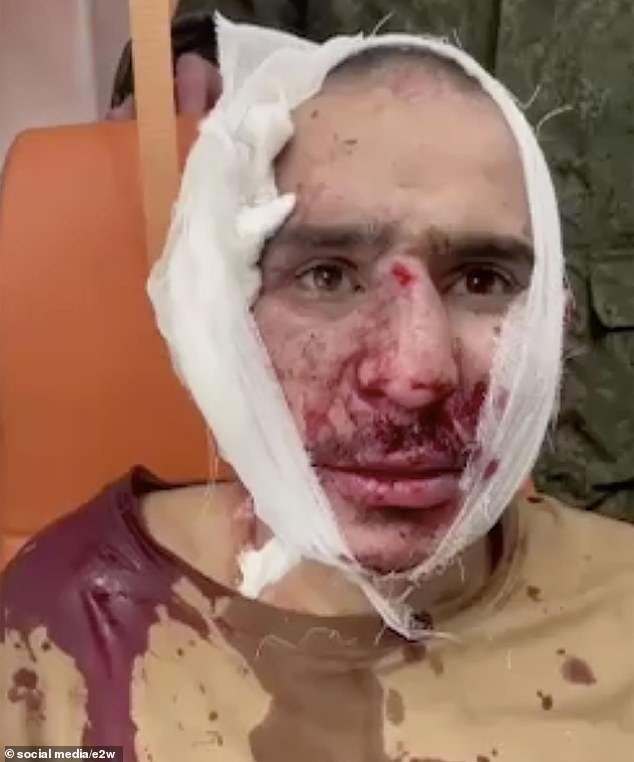 One of the suspected terrorists in the mass shooting at the Crocus City concert hall was paraded on Russian television with a bandage around his ear