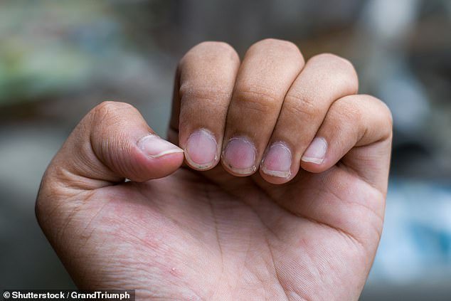 Do dirty fingernails give you the creeps?  According to psychologists, the ick is a feeling of disgust, a primitive emotion designed to keep us safe.