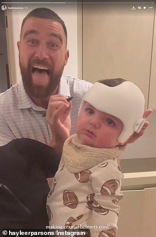 Kelce signed Chrome's skull helmet, which is fitted to correct the shape of a baby's skull