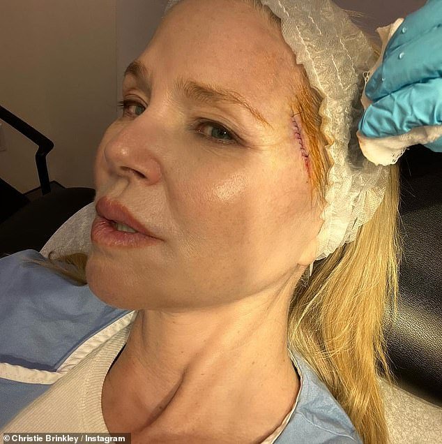 It comes almost a month after she revealed she had undergone surgery after doctors found 'basal cell carcinoma' on her face in a social media post