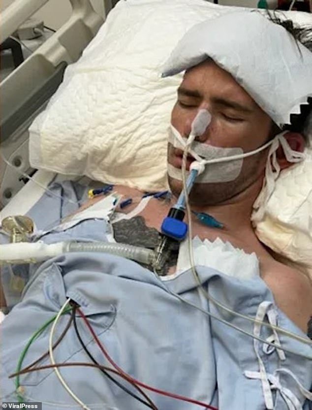 Ben's sister Imogen said he had 'kidney failure and severe pneumonia' and is now in a coma with a ventilator supporting his breathing.  He hasn't woken up in five days