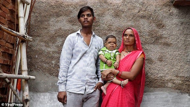His mother (right), who now carries him around on her hip, said they heard he was suffering from a 'thyroid disease' that was stunting his growth
