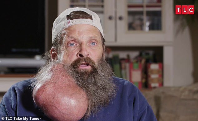 The technician was never able to remove his tumor because he had no health insurance or the money to pay for the surgery himself