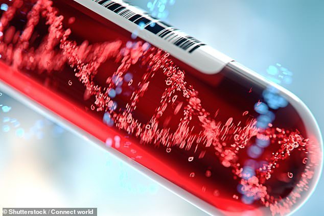The researchers analyzed blood serum from 200 women, half of whom had been diagnosed with osteoarthritis and the other half without the disease (stock image)