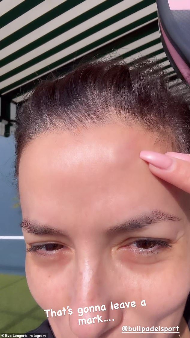 In a video shared to Instagram, the actress pointed out her bruised and swollen forehead after revealing she took a hard hit on the court and hit her head