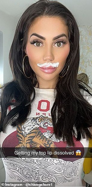 Chloe Ferry, 27, has announced she is removing her upper lip filler - just two weeks after undergoing breast reduction surgery in Turkey