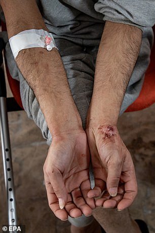 IDF forces have been accused of beating and torturing captured Palestinians, including UN personnel