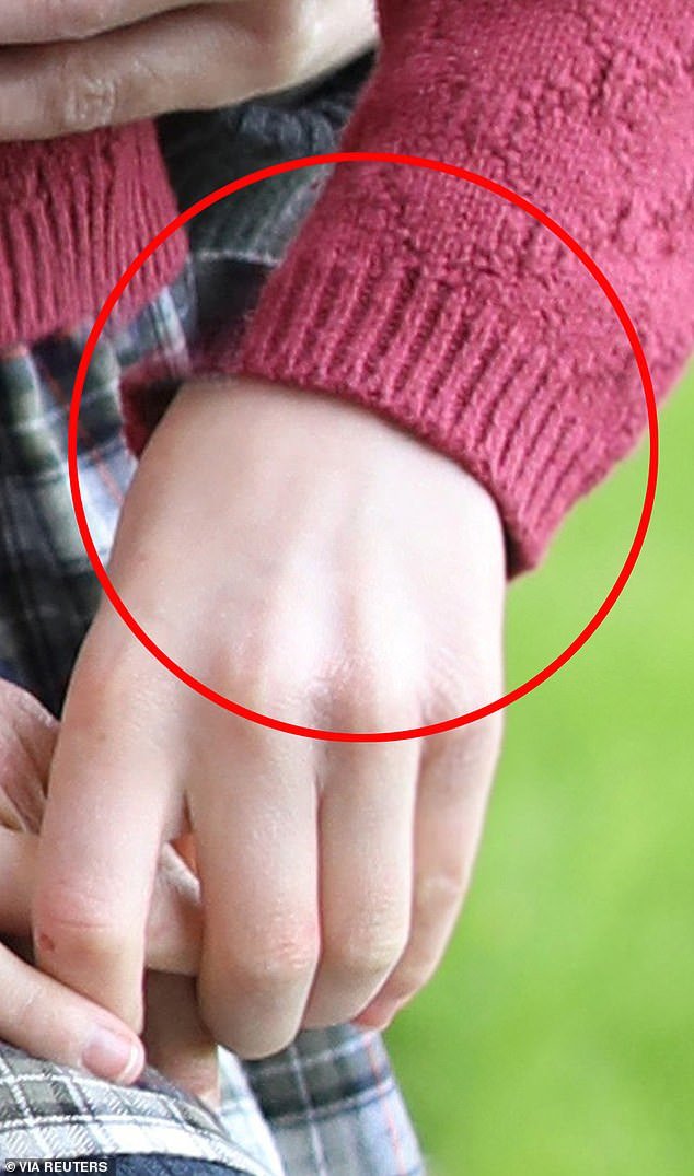 It looked like Charlotte's hand was copied from another photo because there was an empty space where her sleeve should be