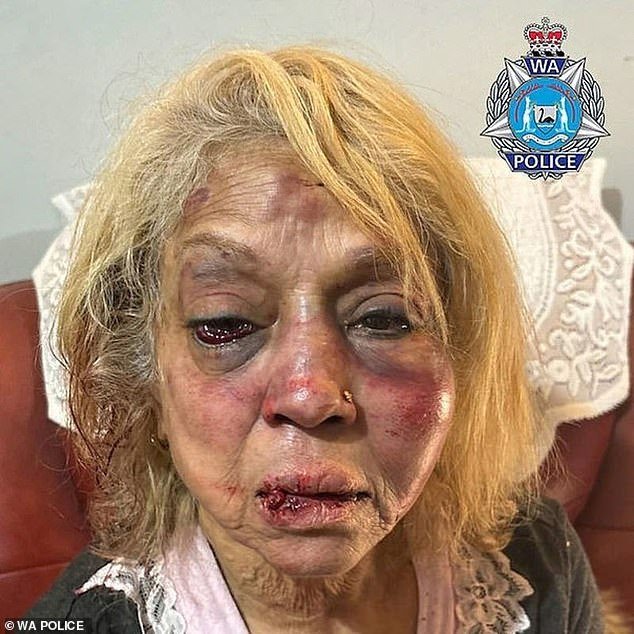 Another released inmate, Majid Jamshidi Doukoshkan, 43, is one of three people charged over the alleged brutal bashing of 73-year-old Ninette Simmons (pictured)