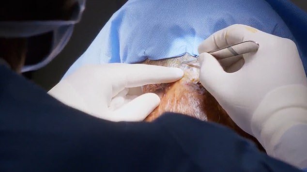Dr.  Ryan Osborne performed surgery to remove the mass from Arlin's neck, which he said could have caused permanent damage to the spine due to its position
